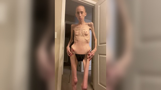 anorexic Muse J 05-09-2022 8t00762
