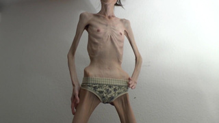 anorexic Denisa 14-12-2020