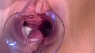 female takes creampie in speculum opened pussy